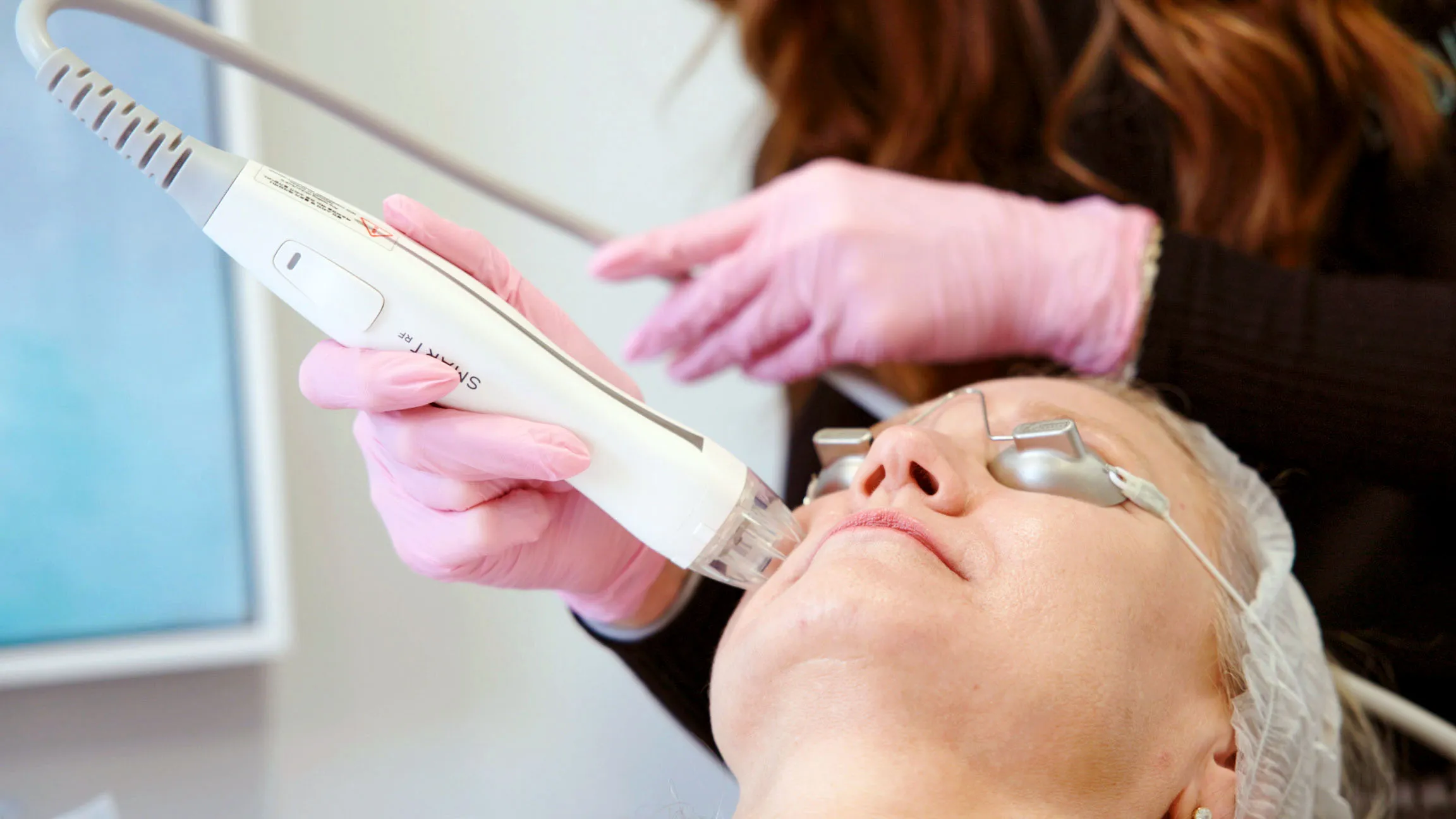 VirtueRF Microneedling