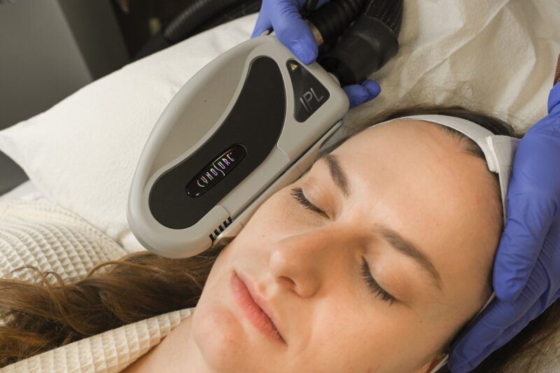 BodyLase® Med Spa - BBL vs IPL BodyLase e1764793127895