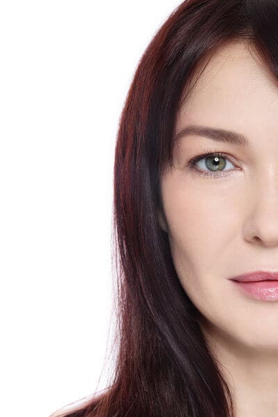 3 Laser Skin Treatments for Wrinkles, Redness, and Spots