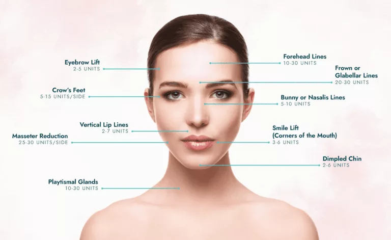 Botox Areas