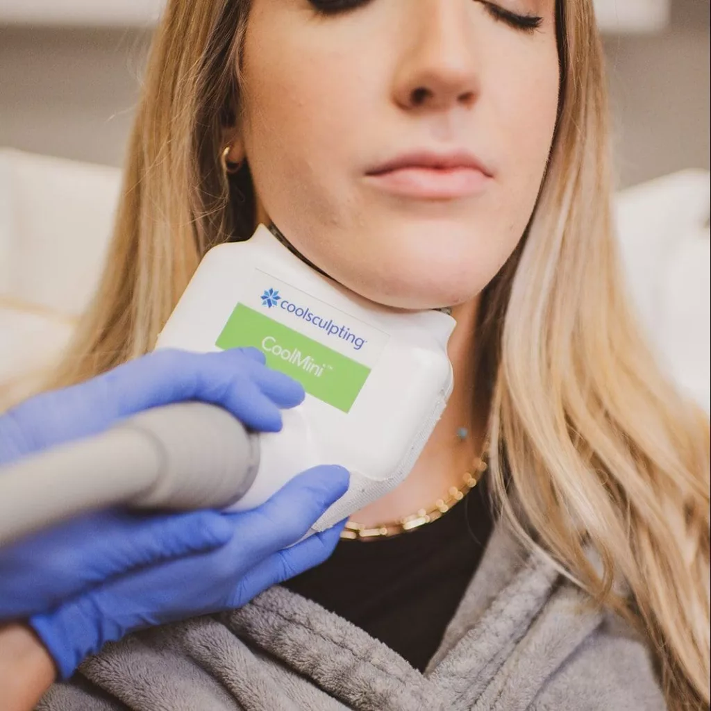 BodyLase® Med Spa - CoolSculpting2 e1629922148816 edited