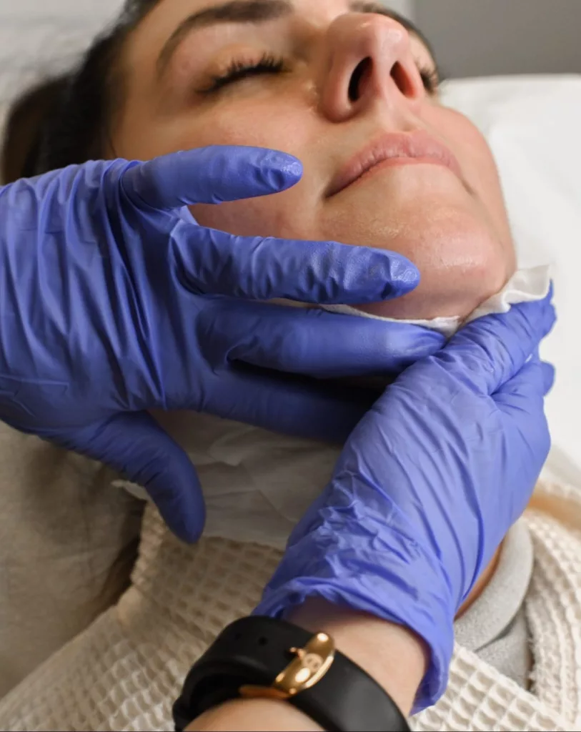 BodyLase® Med Spa - Kybella 1 scaled e1627593318547