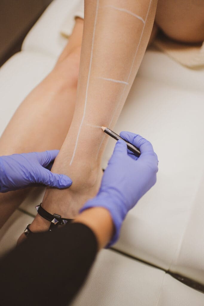 BodyLase® Med Spa - LaserHairRemoval2 38 683x1024 1