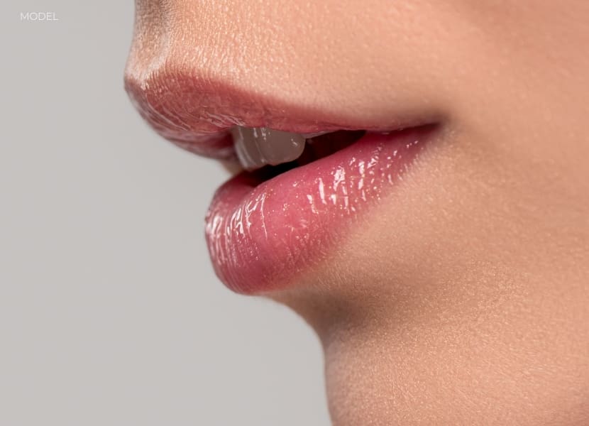 BodyLase® Med Spa - lip fillers 2