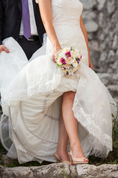 Wedding Series: Laser Hair Removal
