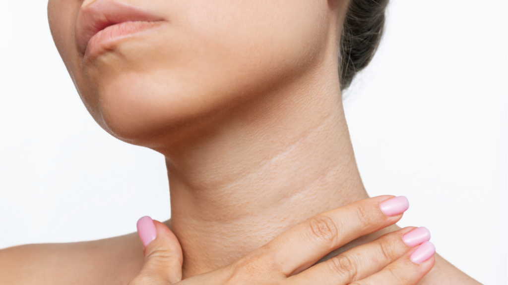 BodyLase® Med Spa - tech neck treatment raleigh durham chapel hill cary.jpg.png